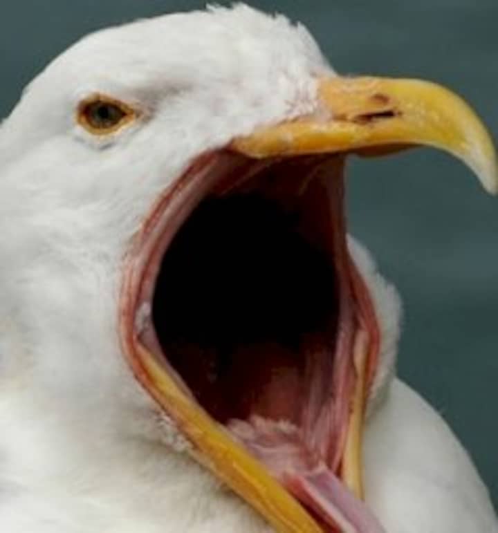 Feedbek